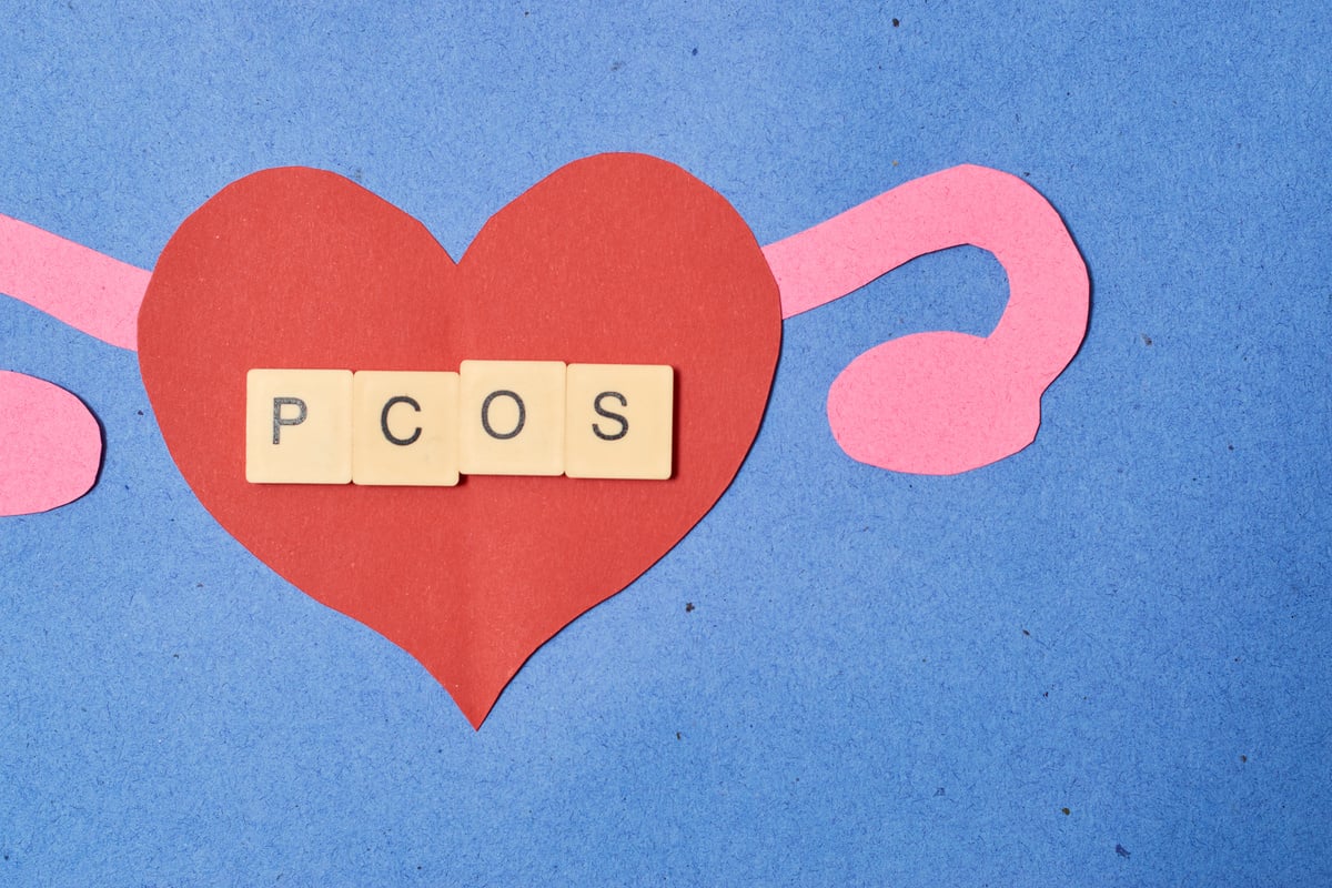 Concept polycystic ovary syndrome, PCOS. Women reproductive